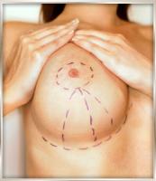 Фото к теме статьи: Пластика женской груди