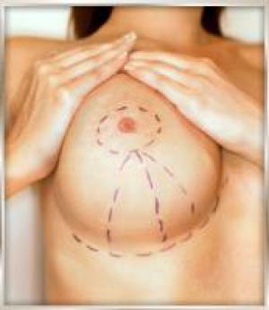 Пластика женской груди